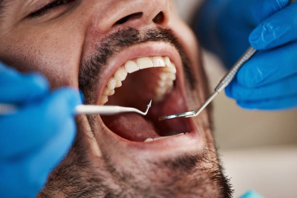 Best Emergency TMJ Treatment in Jena, LA