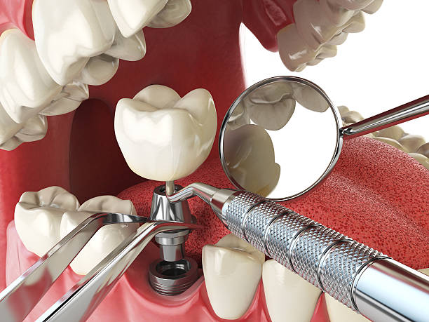 Best Same-Day Emergency Dental Services in Jena, LA
